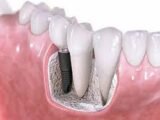 Dental Specialist in Jalandhar
